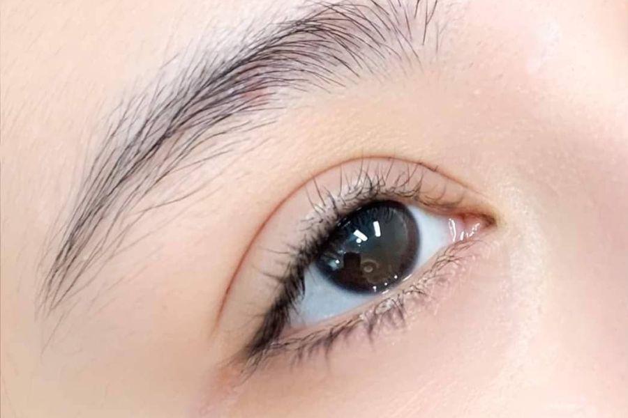 Nhấn mí kiêng gì? – TOP 6+ thực phẩm cần kiêng 15 Bổ sung nhiều thực phẩm chưa vitamin C để vết thương nhanh lành