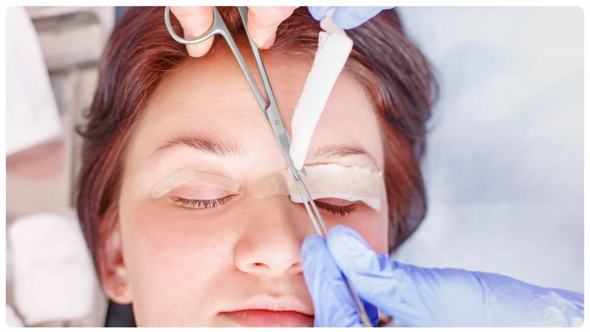 Cắt Mí Mắt Kiêng Ăn Gì? Những lưu ý sau khi phẫu thuật 18 cắt mí mắt kiêng gì