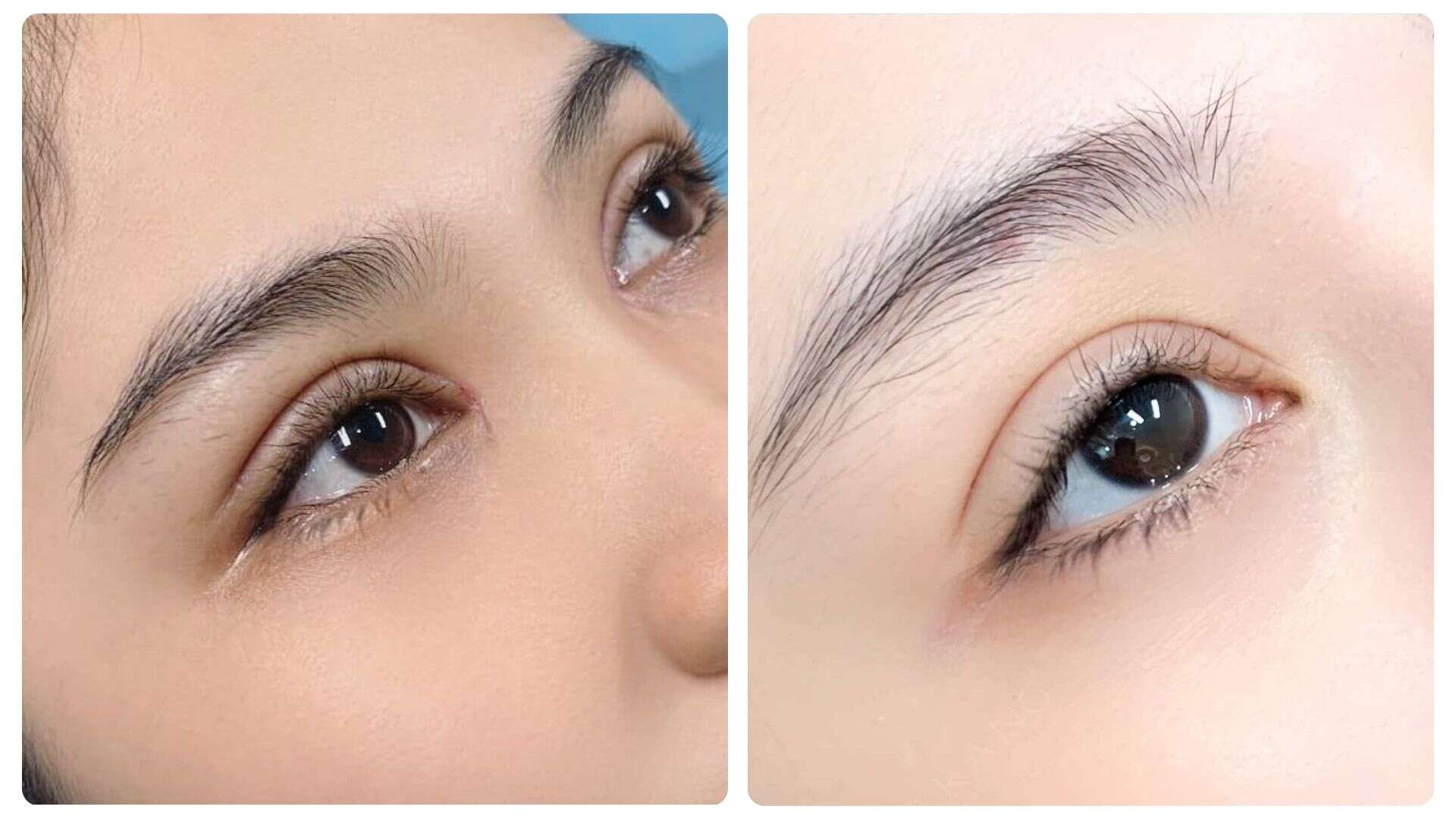 Cắt Mí Mắt Kiêng Ăn Gì? Những lưu ý sau khi phẫu thuật 11 Mức độ quan trọng của việc kiêng ăn sau cắt mí mắt