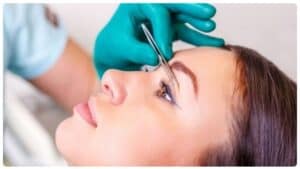 Cắt mí mắt kiêng ăn gì