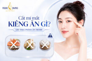 Cắt mí mắt kiêng ăn gì