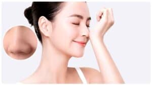 Dáng mũi ổn định nhanh hơn khi tuân thủ đúng hướng dẫn hậu phẫu