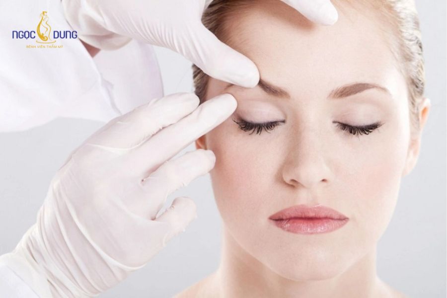 Đường khâu vi phẫu siêu mảnh ẩn sát đường viền lông mày, không để lại sẹo xấu lộ liễu