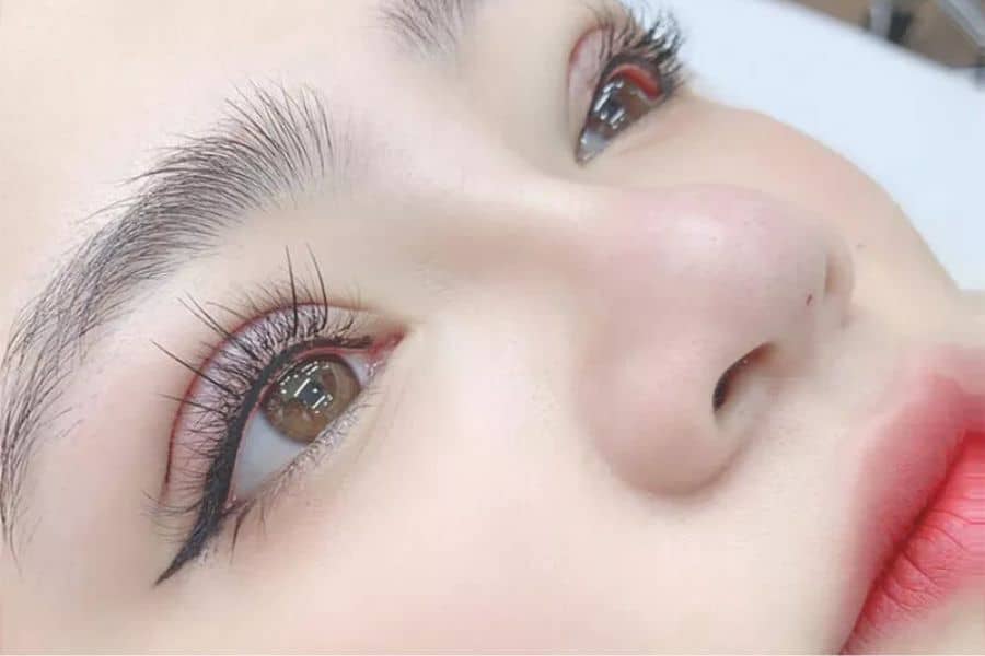 Tầm quan trọng và cách chăm sóc mí mắt sau khi cắt chỉ 16 Duy trì chế độ ăn uống khoa học để hạn chế sẹo, thâm sau cắt mí