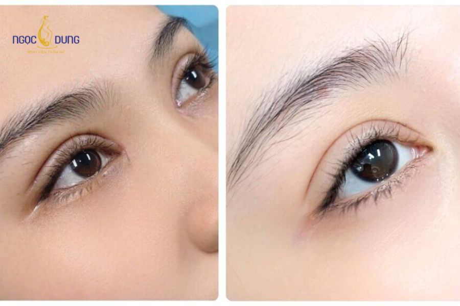 Cắt mí kiêng ăn gì? Thực phẩm không nên ăn sau khi cắt mí 10 Hiểu rõ nhóm chất cần kiêng giúp phòng ngừa tối đa nguy cơ viêm và biến chứng sẹo
