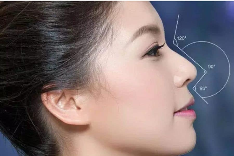 Có nên nâng mũi không, những ai nên và không nên nâng mũi? 11 Không nên sửa mũi nếu dáng mũi không quá xấu