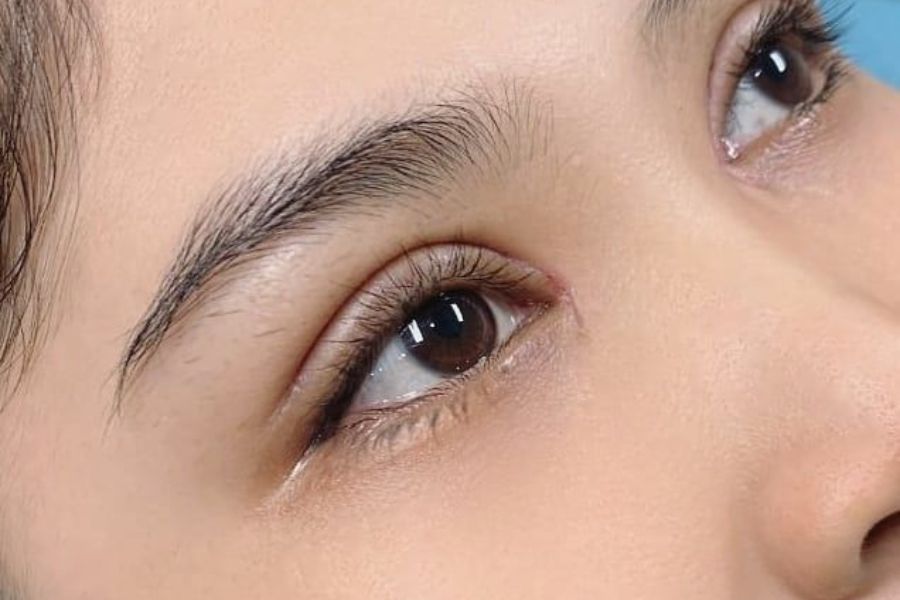 TOP 7+ cách giảm sưng mắt sau cắt mí và lưu ý nên biết 12 Lựa chọn cơ sở cắt mí uy tín để có đôi mắt đẹp