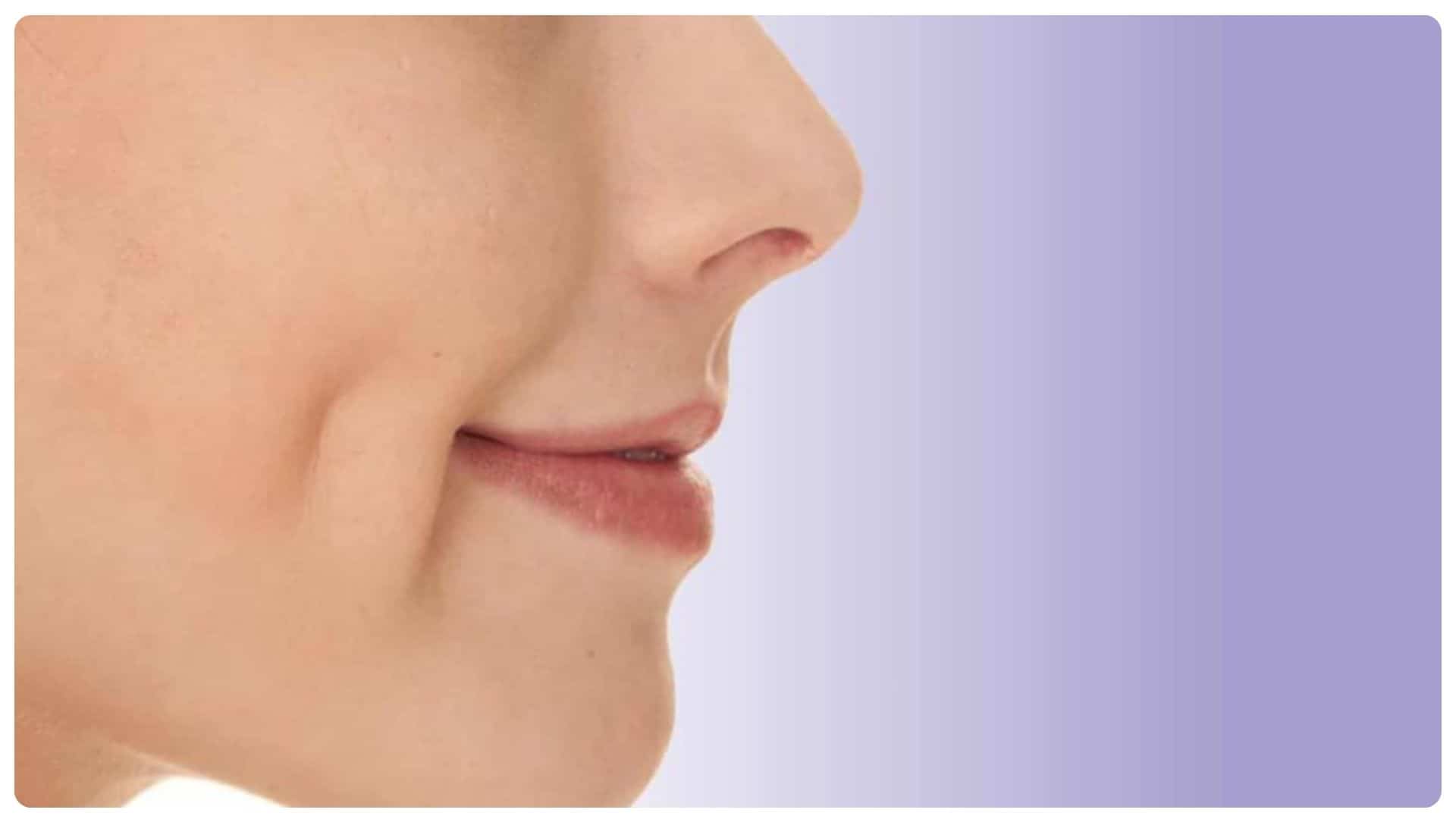 Má lúm đồng tiền có ý nghĩa gì? Có những loại má lúm nào 18 ma lum dong tien co y nghia gi 10