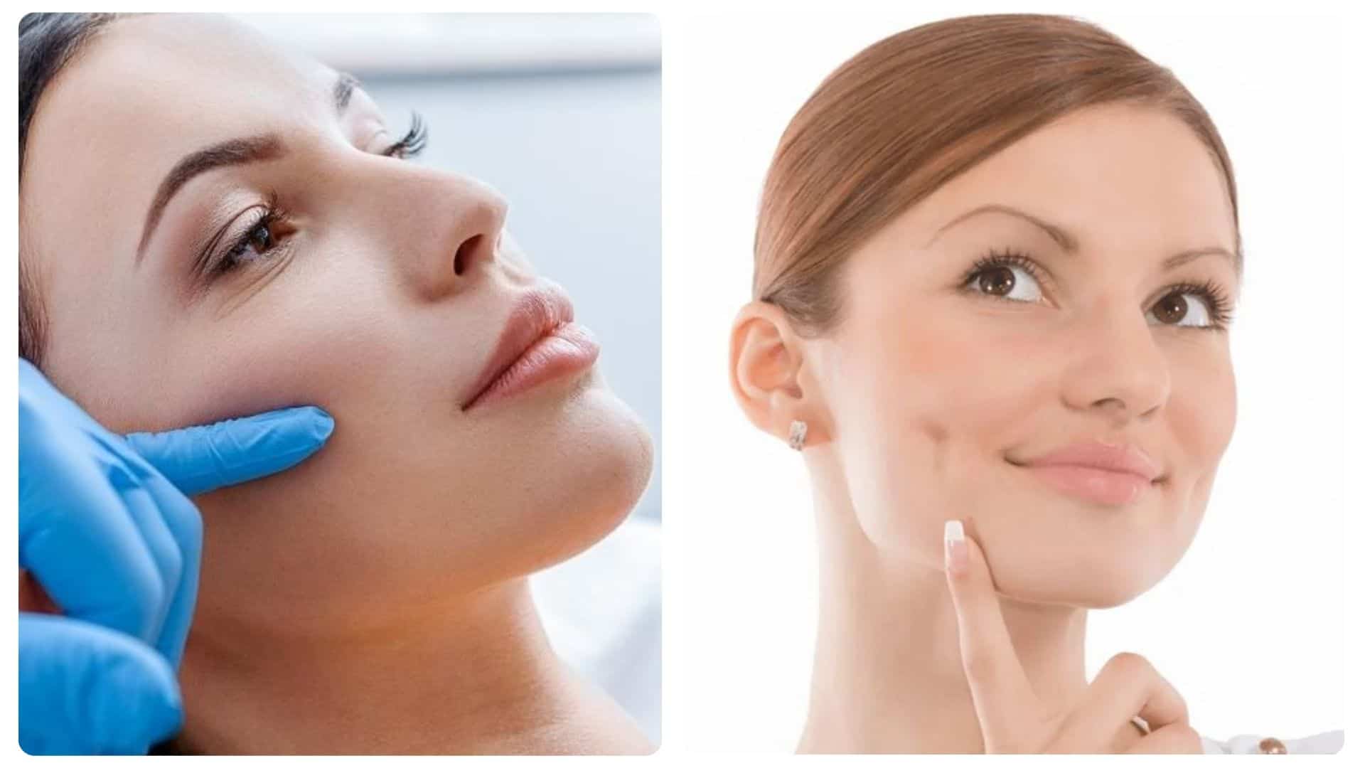 Má lúm đồng tiền có ý nghĩa gì? Có những loại má lúm nào 20 ma lum dong tien co y nghia gi 13