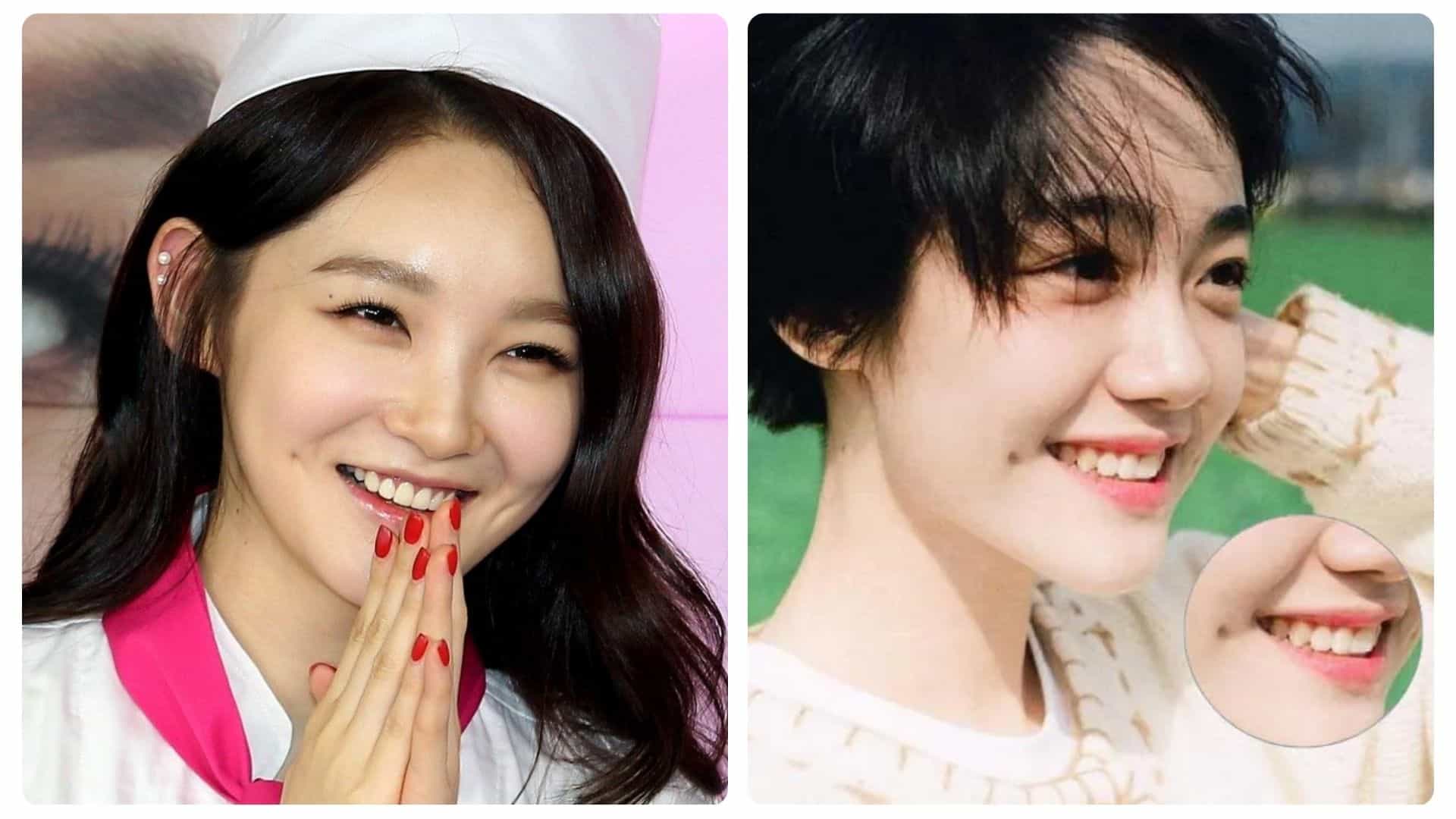 Má lúm đồng tiền có ý nghĩa gì? Có những loại má lúm nào 13 ý nghĩa của má lúm