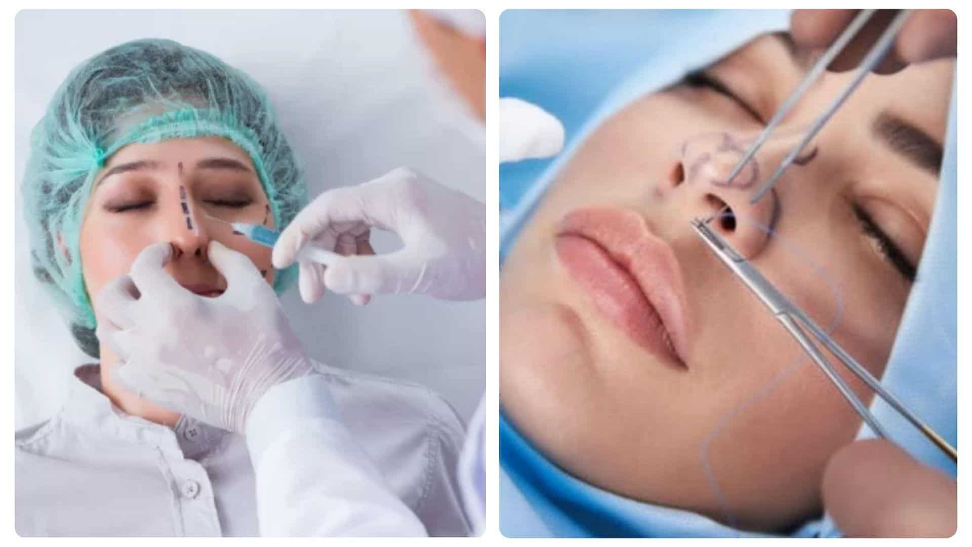 Nâng mũi chỉ giữ được bao lâu? Cách chăm sóc dáng mũi bền lâu 18 Mỗi bước nâng mũi tại Ngọc Dung đều được thực hiện bởi bác sĩ chuyên môn cao