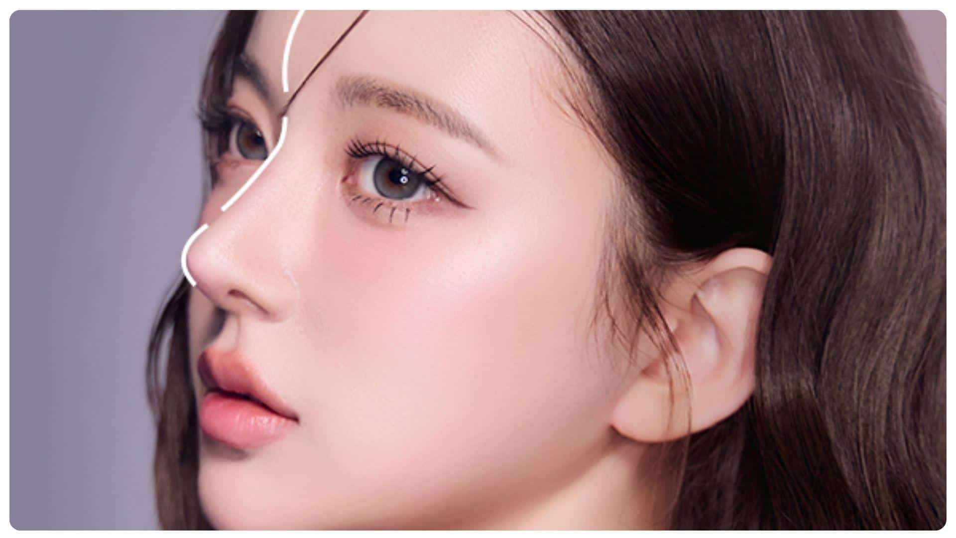 Nâng mũi chỉ giữ được bao lâu? Cách chăm sóc dáng mũi bền lâu 13 Nâng mũi bằng chỉ giữ được bao lâu phụ thuộc cơ địa và cách chăm sóc