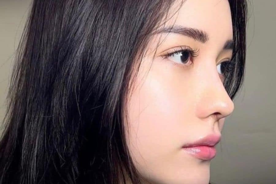 Nâng mũi cấu trúc bao lâu thì gom lại? Quá trình mũi gom lại 10 nâng mũi cấu trúc bao lâu thì gom lại