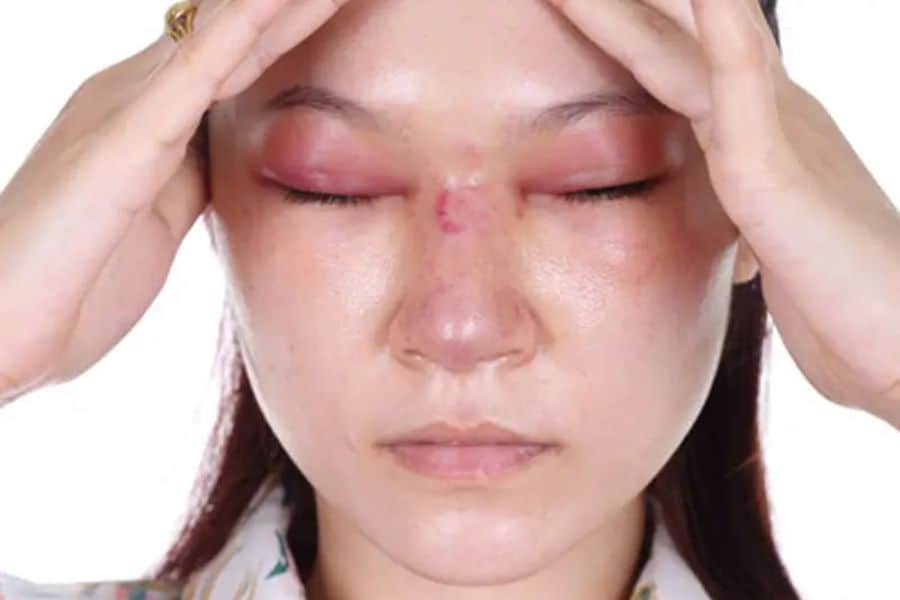 Nâng mũi cấu trúc bao lâu thì gom lại? Quá trình mũi gom lại 11 nâng mũi cấu trúc bao lâu thì gom lại