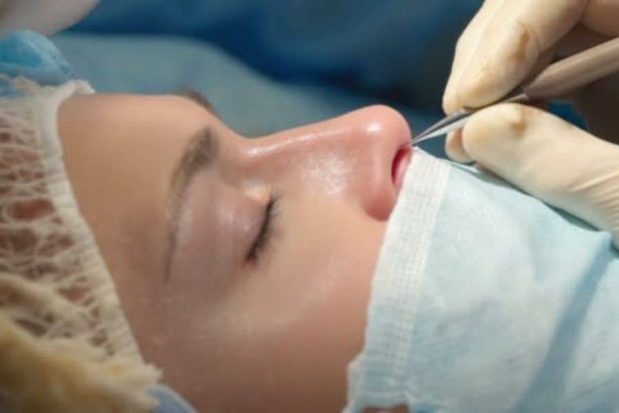 Nâng mũi cấu trúc được bao lâu? Các yếu tố ảnh hưởng 9 Nâng mũi cấu trúc giữ được thời gian khá dài nếu chăm sóc đúng cách