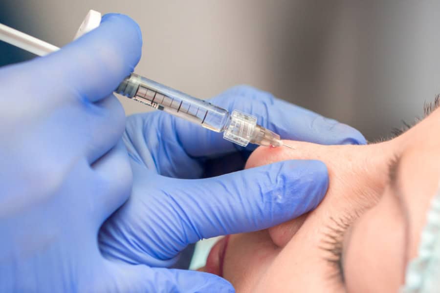 Tiêm chất làm đầy nâng mũi hiệu quả bao lâu? Giải đáp từ A-Z 27 Thời gian ổn định của dáng mũi sau khi tiêm filler còn phụ thuộc vào kỹ thuật, loại filler,...