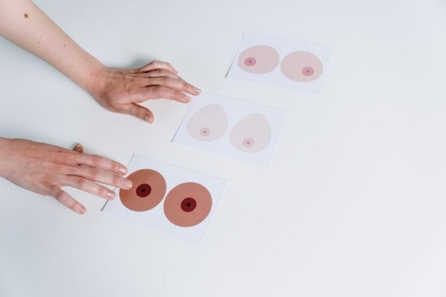 Thu nhỏ quầng nhũ hoa giá bao nhiêu? Bảng giá mới nhất 2026 12 Tình trạng quầng nhũ hoa quyết định đến giá thu nhỏ quầng vú