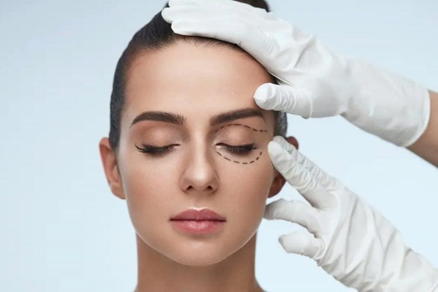 Cắt mí mắt có đau không? Địa chỉ cắt mí an toàn, uy tín 15 Bác sĩ sẽ thăm khám cẩn thận trước khi cắt mí mắt