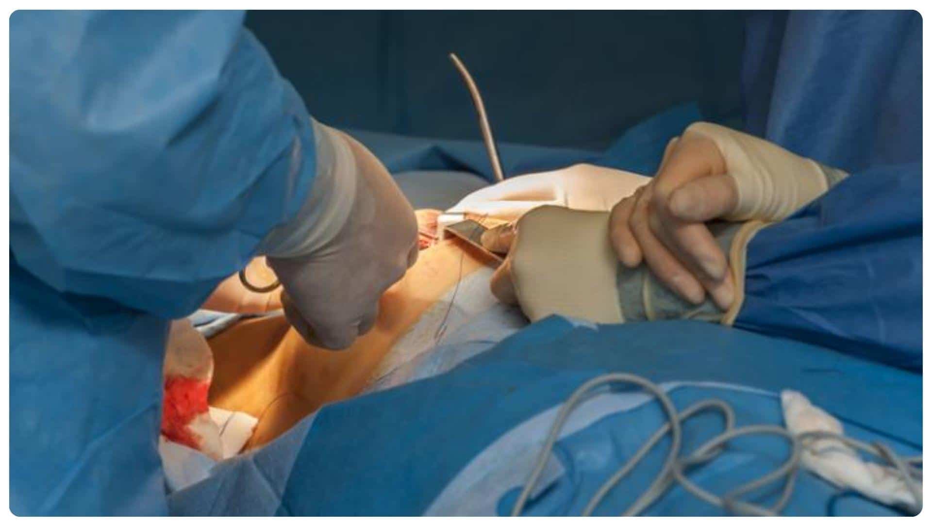 Nâng ngực có đau không? Những yếu tố nào ảnh hưởng 12 Bác sĩ tay nghề cao giúp hạn chế xâm lấn và giảm đau hiệu quả