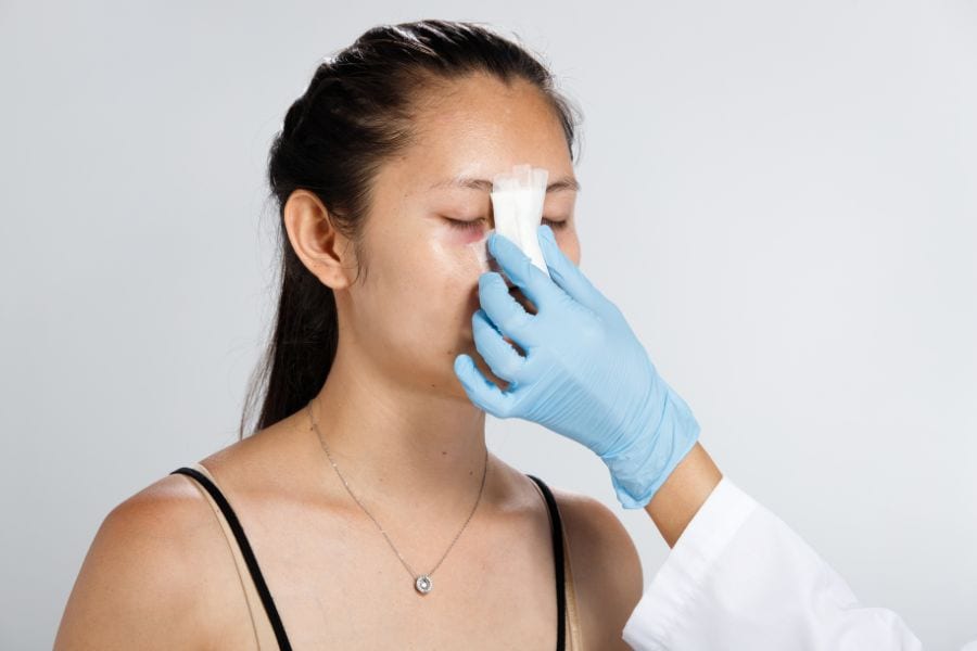 Nâng mũi bao lâu thì đi xe máy được? Những hạn chế cần lưu ý 8 Các rung động mạnh từ xe máy có thể tác động trực tiếp lên vùng mũi