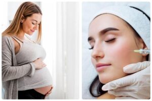 Có bầu tiêm filler được không? là thắc mắc của nhiều người
