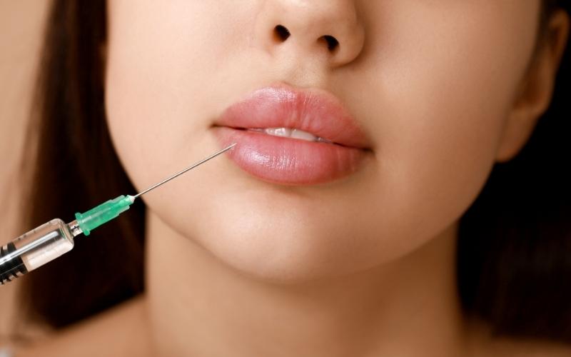 Tiêm filler bao lâu thì tan hết? Yếu tố ảnh hưởng đến độ bền 6 Tiêm filler bao lâu thì tan hết? Cơ địa thích ứng của mỗi người cũng ảnh hưởng đến độ bền khi tiêm filler