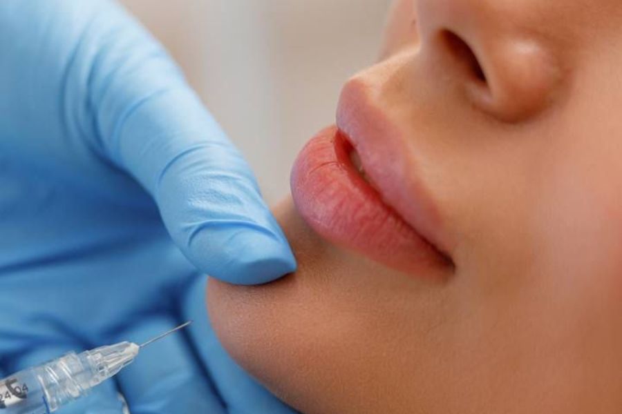 Tiêm filler cằm bao lâu thì đẹp tự nhiên? Những yếu tố liên quan 14 Có nhiều yếu tố tác động đến kết quả tiêm filler cằm bao lâu thì đẹp