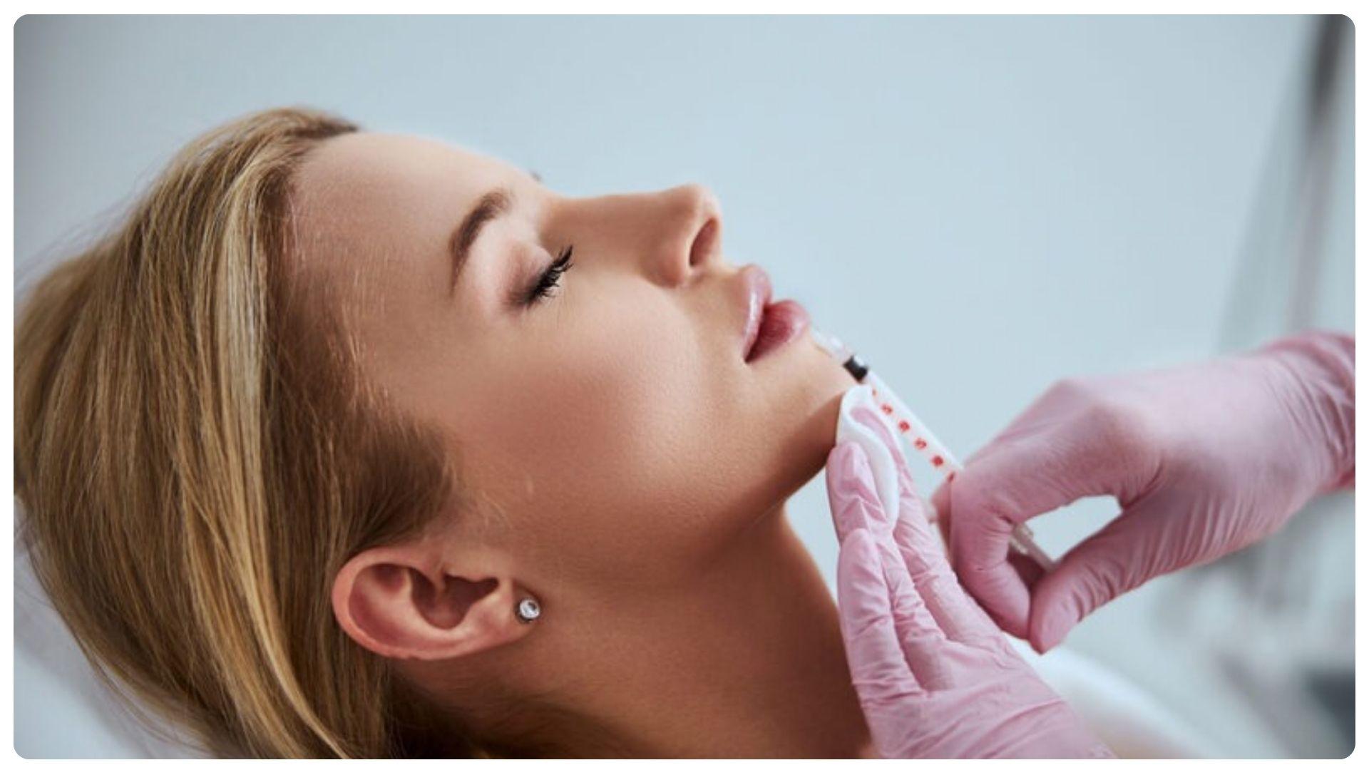 Tiêm filler bao lâu thì vào form? Các yếu tố ảnh hưởng 14 Dáng cằm ổn định và rõ nét nhất sau khoảng 1 tháng