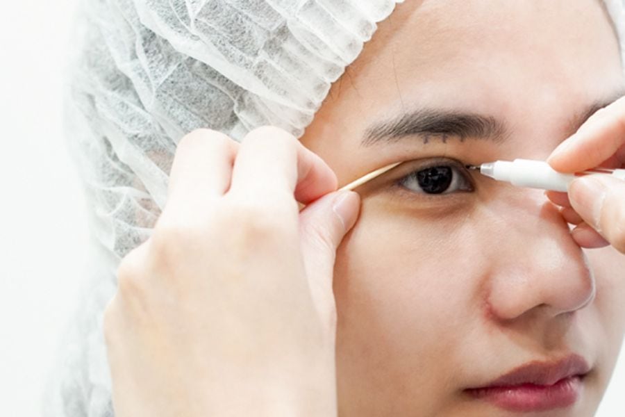 Nâng cung mày bao lâu thì hết sẹo? Yếu tố nào ảnh hưởng 13 Duy trì chế độ chăm sóc vùng mắt theo dặn dò của bác sĩ