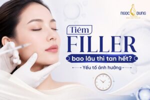 filler bao lau thi tan het