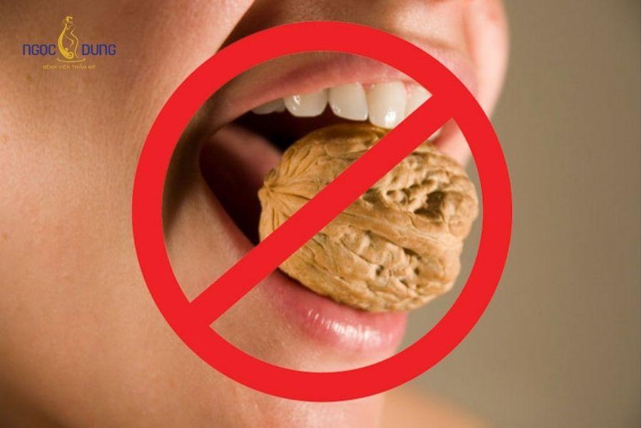 Tiêm filler cằm là gì? Những lưu ý để có dáng cằm tự nhiên 12 Hạn chế ăn thực phẩm cứng để tránh việc filler bị xê dịch