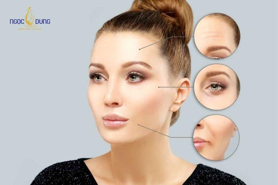 Tiêm botox xóa nhăn là gì? Ưu & nhược điểm và lưu ý cần biết 12 Hiệu quả thường chỉ duy trì được trong thời gian ngắn khoảng vài tháng