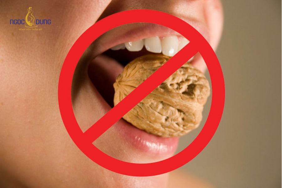 Tiêm botox gọn hàm kiêng gì? Cách chăm sóc da an toàn 10 Không ăn các thực phẩm cứng như đồ khô để tránh việc cơ cắn phải vận động liên tục