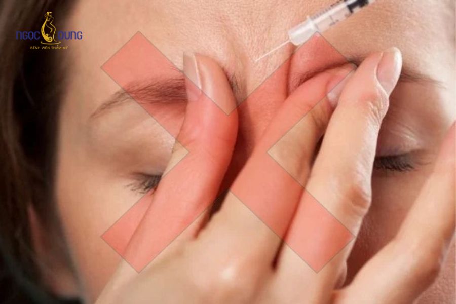 Tiêm Botox là gì? Những công dụng của tiêm botox hiện nay 13 Không massage vùng tiêm sau khi thực hiện tiêm botox để tránh gây ảnh hưởng