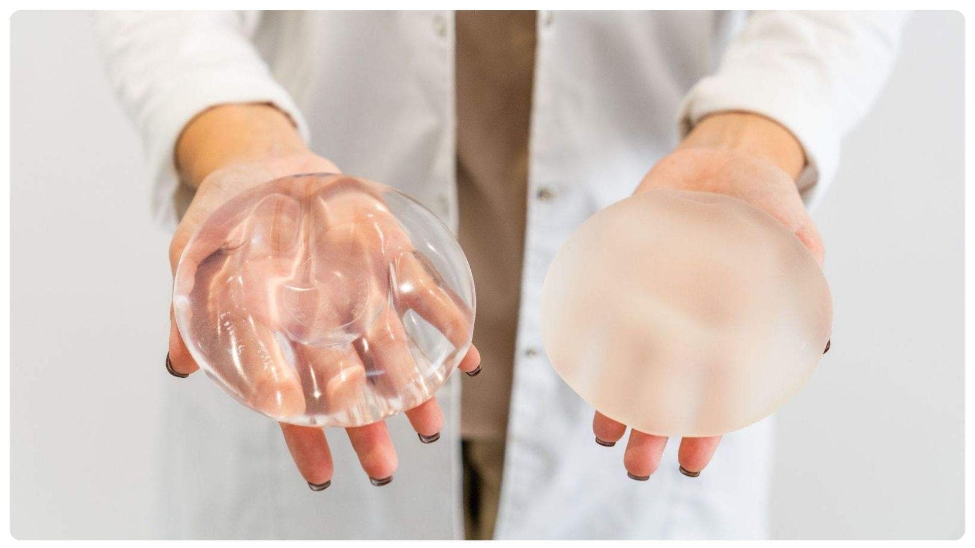 Nâng ngực bao lâu thì mềm? Những yếu ảnh hưởng cần lưu ý 15 Loại túi độn cũng ảnh hưởng đến tốc độ mềm và thời gian hồi phục sau nâng ngực