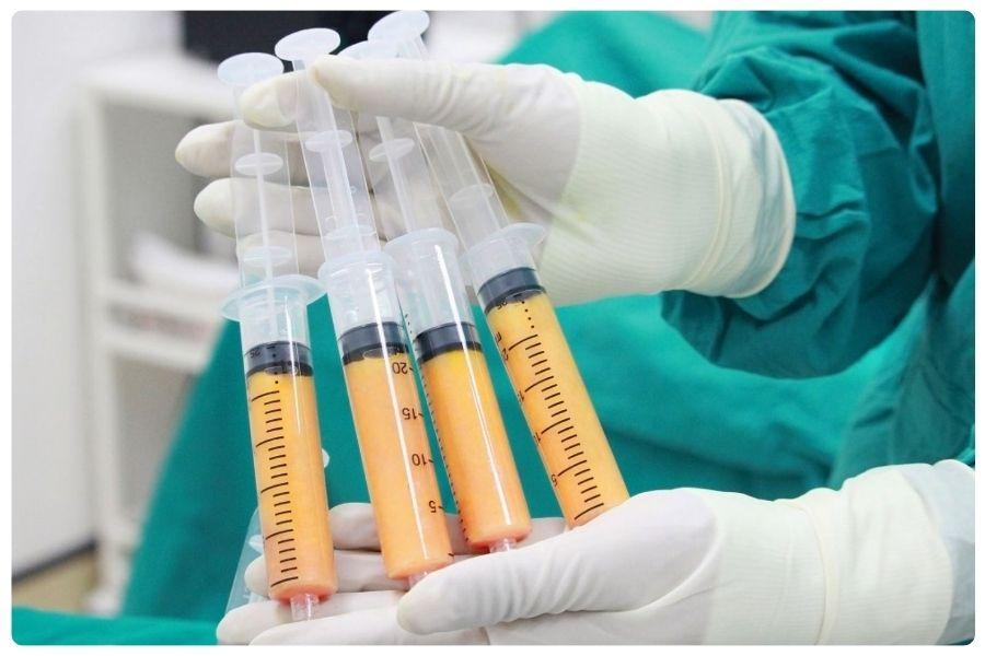 Nên Cấy Mỡ Tự Thân Hay Tiêm Filler? Nên chọn phương pháp nào 12 Mỡ tự thân mang lại hiệu quả lâu dài và tương thích cao