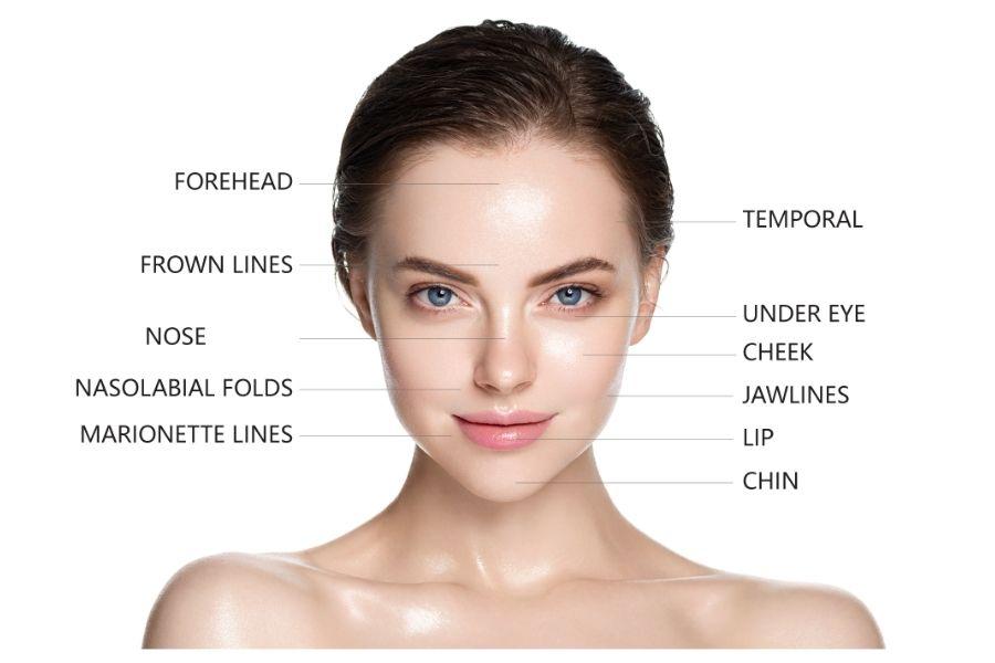 1cc filler bằng bao nhiêu ml? Có an toàn khi tiêm 1cc ? 12 Mỗi vùng tiêm sẽ cần lượng filler khác nhau