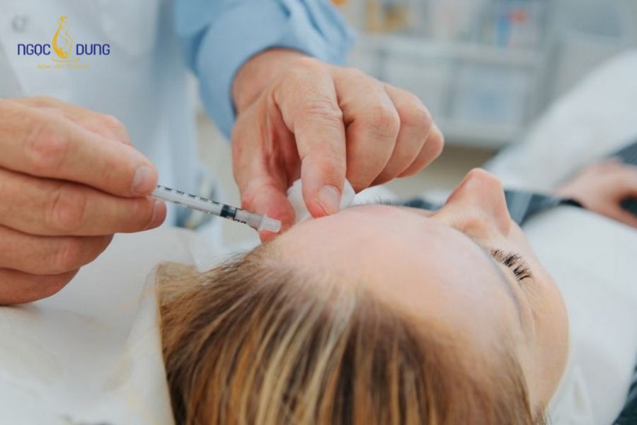 Bảng giá tiêm botox bao nhiêu tiền? Những yếu tố ảnh hưởng 6 Mức giá tiêm botox tuỳ thuộc vào diện tích vùng điều trị và nhu cầu thực tế của khách hàng