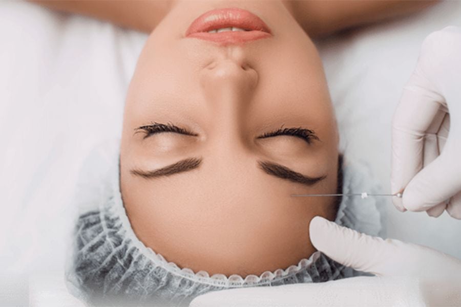 Nâng cung mày bao lâu thì hết sẹo? Yếu tố nào ảnh hưởng 9 Nâng cung chân mày thường lành sẹo sau 3-6 tháng