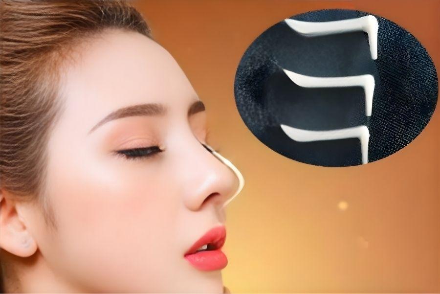 Nâng mũi sụn Surgiform và những ưu điểm nổi bật 6 Nâng mũi sụn Surgiform tạo dáng mũi thanh tú, tự nhiên