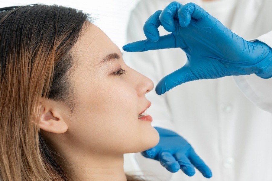 Nâng mũi bằng chỉ là gì? Những ai nên thực hiện 7 Nâng mũi bằng chỉ là phương pháp thẩm mỹ không phẫu thuật