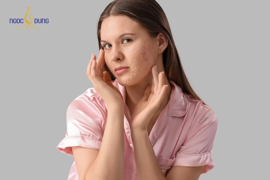 Tiêm botox xóa nhăn là gì? Ưu & nhược điểm và lưu ý cần biết 16 Nếu có tiền sử dị ứng dược phẩm, hãy thông báo ngay cho bác sĩ trước khi thực hiện