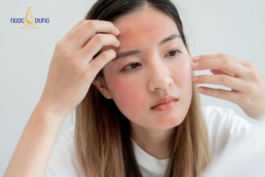 Tiêm botox có hại không? Những lưu ý giảm các biến chứng? 11 Người bị dị ứng thành phần thuốc không nên thực hiện tiêm botox để tránh các biến chứng không mong muốn