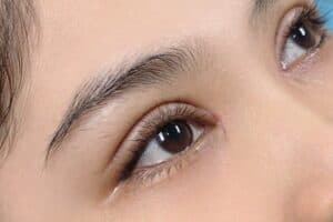 Nhấn mí mắt là lựa chọn phổ biến hiện nay