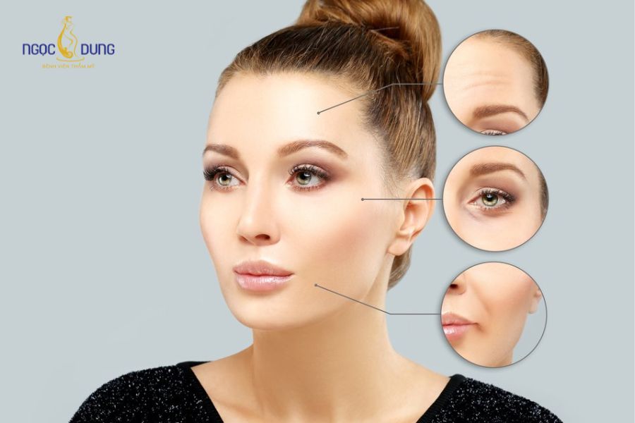 Tiêm Botox là gì? Những công dụng của tiêm botox hiện nay 11 Những người gặp các khuyết điểm về rãnh cười, nhăn vùng trán,... nên tiêm botox để khắc phục
