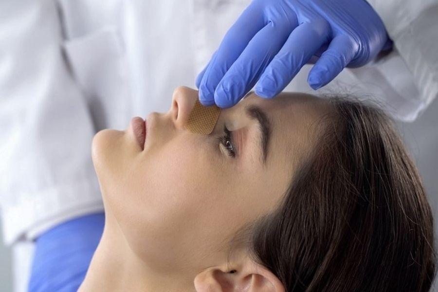 Nâng mũi Nanoform là gì? Lưu ý khi nâng mũi Nanoform 8 Phương pháp nâng mũi NanoForm giúp hạn chế tối đa việc hình thành bao xơ quanh sụn