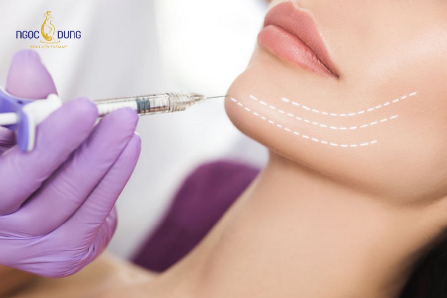 Filler Juvederm là gì? Có những loại filler Juvederm nào? 13 Quy trình tiêm filler Juvederm cần đảm bảo tiêu chuẩn về mặt y khoa để an toàn, tránh biến chứng