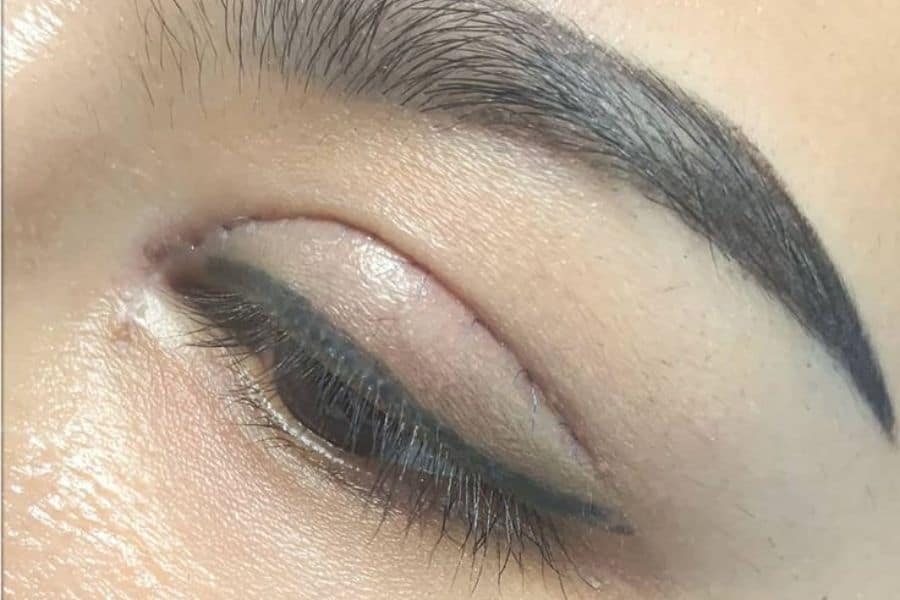 Nhấn mí có đau không? Những điều cần biết trước khi thực hiện 13 Sau nhấn mí cần chăm sóc vùng mắt cẩn thận