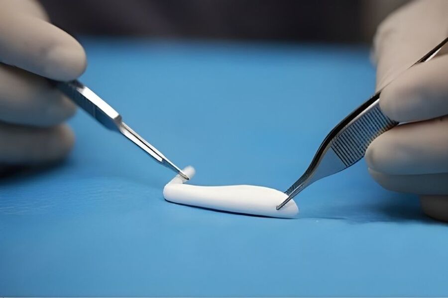 Surgiform là loại sụn nhân tạo cao cấp được cấu tạo từ 100% ePTFE