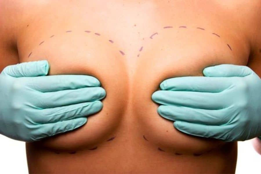 Nâng ngực có được vĩnh viễn không? Yếu tố ảnh hưởng 11 Tăng kích thước vùng ngực giúp chị em tự tin hơn